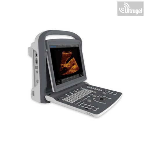 CHISON ECO2 VET - hordozható állatorvosi ultrahang készülék