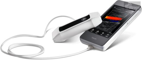 GE VScan hordozható ultrahang