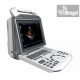 Zoncare M5 -  color doppleres ultrahang 1 vizsgálófejjel