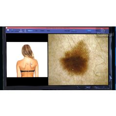   Videodermatoszkóp és adatnyilvántartó rendszer - HORUS HS400