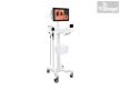 Vision EF flexible Laringo Fiberoscope - Rhino laryngoscope with 10" HD monitor