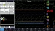 Betegellenőrző transzport monitor - Comen K1