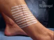 3M Steri-Strip™ sebzáró csík 75 x 3 mm R1540 (50lap/dob)