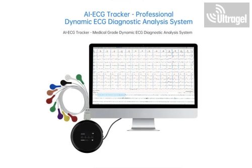Holter EKG 12 csatornás, 72 órás - M12