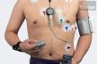 Holter EKG 12 csatornás, 72 órás - M12