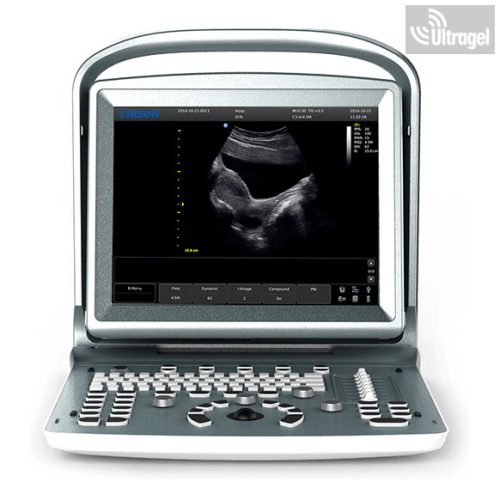 CHISON ECO 5 - hordozható color doppleres ultrahang készülék