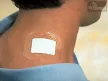 3M TEGADERM™ - PAD 5x7 cm vízálló filmkötszer  3582