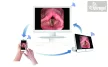 Cisztoszkóp Flexibilis többszörhasználatos, Wifi opció - Vision CF52