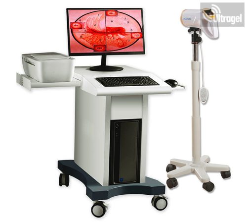 Video  Kolposzkóp Alltion AC4000 HD - Trolley "C" - 3.200.000 pixel