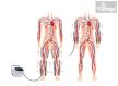 Clinical Lymphatic drainage and compression therapy 8 chamber - COMEN SCD600