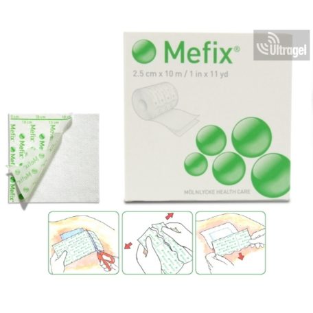 Mölnlycke Mefix®  15cm x 10m - öntapadó anyag kötszer