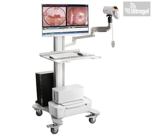 Video  Kolposzkóp Alltion AC4000 HD Medium - Trolly A, 2.000.000 pixel