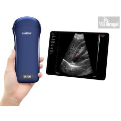   Kézi ultrahang "3in1" color doppler, lineáris,konvex, cardio - Viatom, Wifi