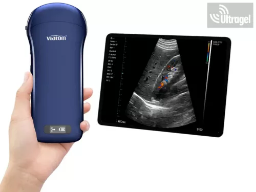 Kézi ultrahang "3in1" color doppler, lineáris és konvex + cardio - Viatom, Wifi