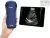 Kézi ultrahang "3in1" color doppler, lineáris és konvex + cardio - Viatom, Wifi