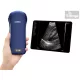 Kézi ultrahang "3in1" color doppler, lineáris és konvex + cardio - Viatom, Wifi