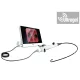 Bronhoszkóp flexibilis, 10" HD monitorral, Wifi opció - Vision BF