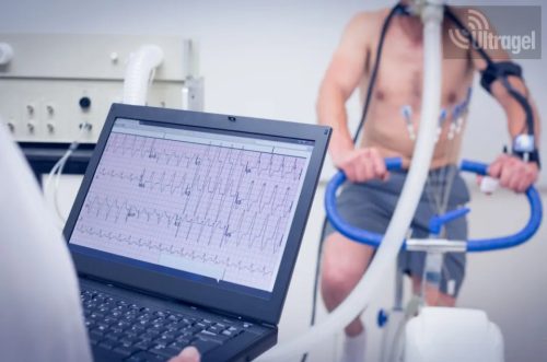 Terheléses EKG - CARDIAX 12 CSATORNÁS TERHELÉSES EKG RENDSZER WIFI modullal