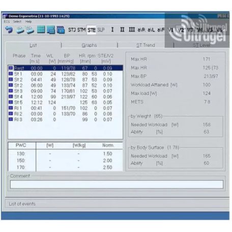 Terheléses EKG - CARDIAX 12 CSATORNÁS TERHELÉSES EKG RENDSZER WIFI modullal
