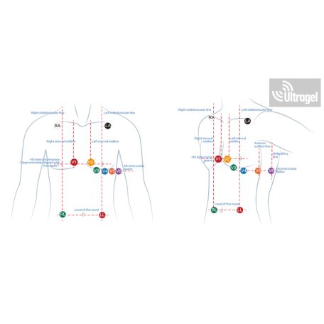 Terheléses EKG - CARDIAX 12 CSATORNÁS TERHELÉSES EKG RENDSZER WIFI modullal