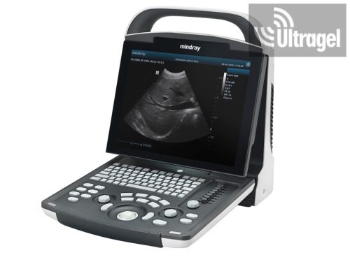 MINDRAY DP-20 - HORDOZHATÓ F/F ULTRAHANG készülék