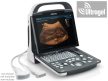 MINDRAY DP-20 - HORDOZHATÓ F/F ULTRAHANG készülék