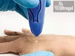 CryoMega® krio készülék - 16gr (kb.30x)