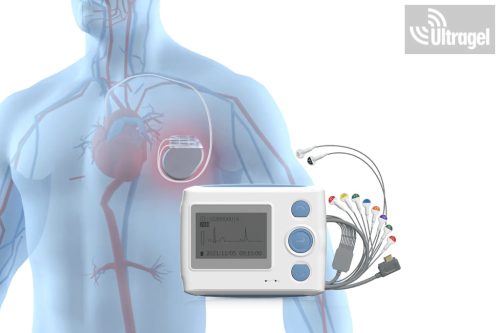 Holter EKG, AI javaslattal, 168 óra - TH12