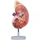 Kidney with adrenal gland + renal corpuscle