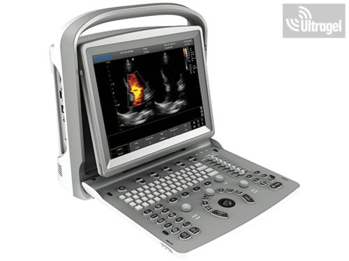 CHISON ECO 6 - hordozható color doppleres ultrahang készülék