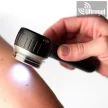 Dermatoszkóp DermLite DL4 - polarizált fényű digitális dermatoszkóp - 10x nagyítás, 18 led