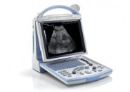 Ultrahang készülékek 